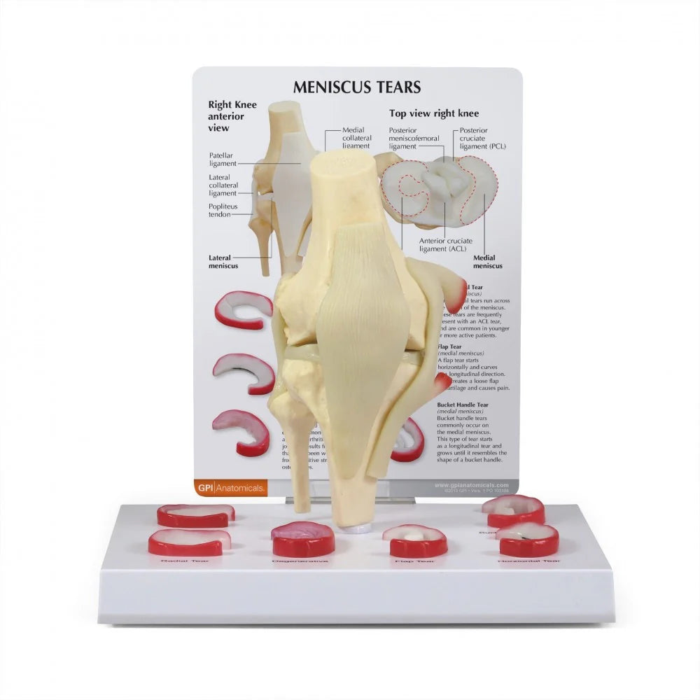 Knee Anatomy & Pathology Collection -