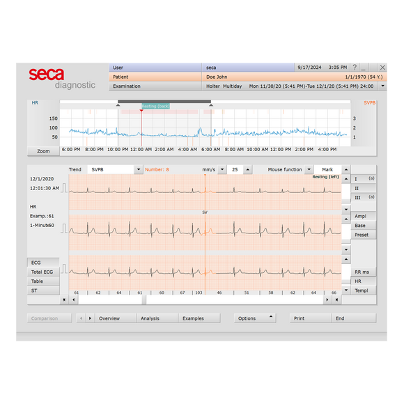 Seca Holter Analysis ECG Sotware -