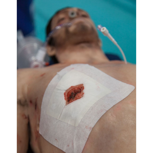 Russell Chest Seal (RCS) - Safeguard Medical