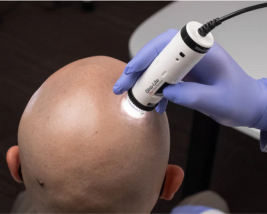 TrichoScope Polarizer Wireless - Dino-Lite