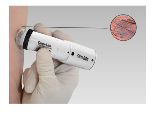 DermaScope Polarizer Wireless - Dino-Lite