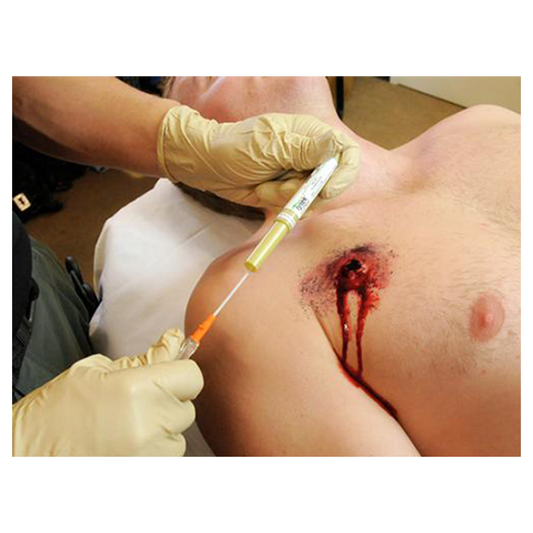 TPAK Chest Decompression Needle - 14 Gauge x 3.25" - TyTek Medical