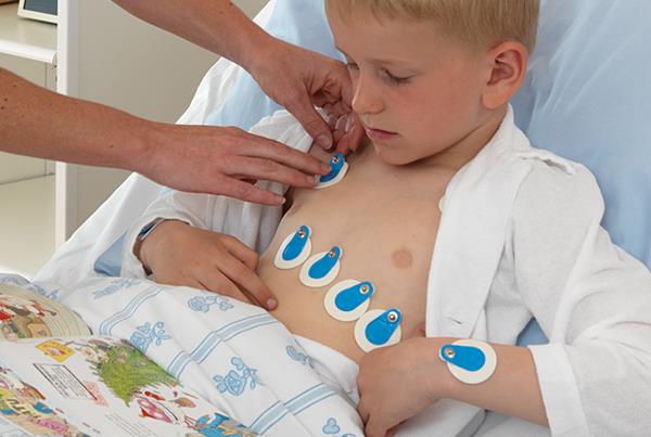 AMBU BlueSensor M ECG Electrodes - Stud Connector - Pack of 50 (40.8 x 34mm) -