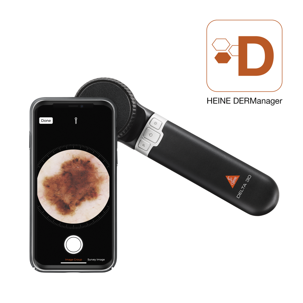 HEINE DELTA 30 Dermatoscope - Over Engraved -