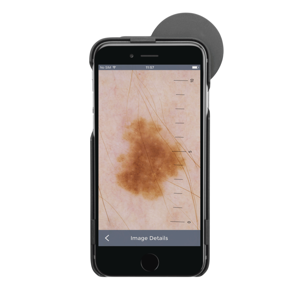 HEINE IC1 With Contact Plate & Scale, Mobile Phone Case IC1/6 -