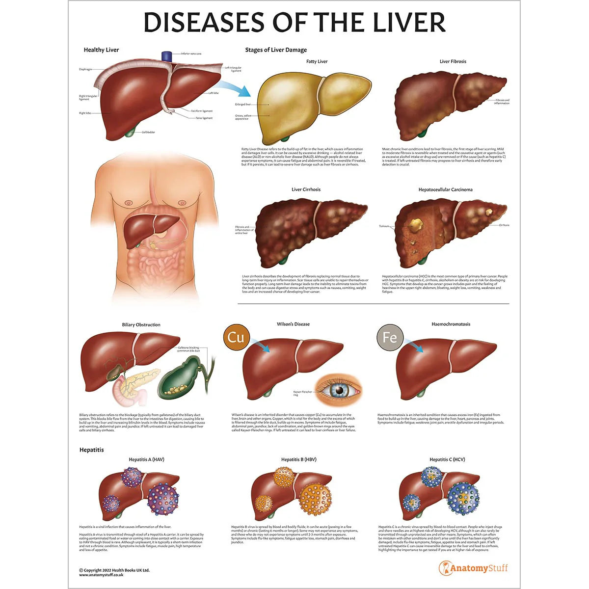 Liver Anatomy & Pathology Collection -