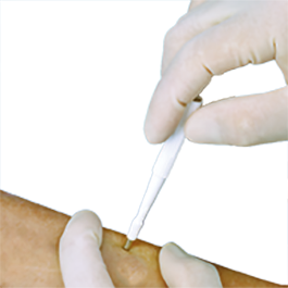 Acu Punch 8mm Biopsy Punches - Box of 10 - Schuco