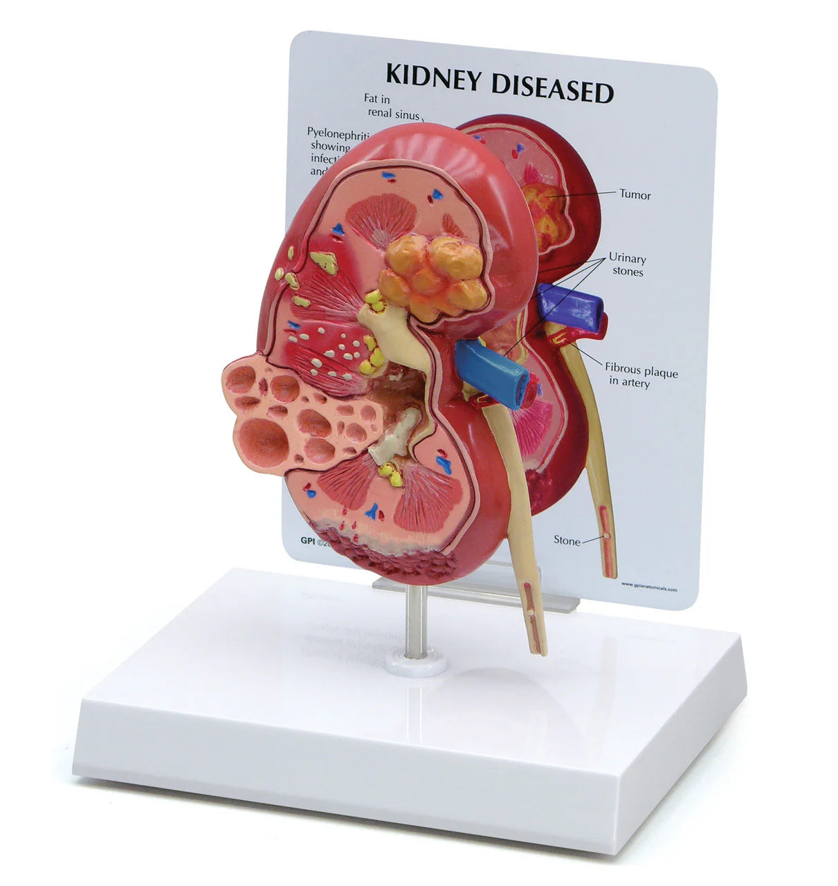 Urinary System Anatomy Collection -