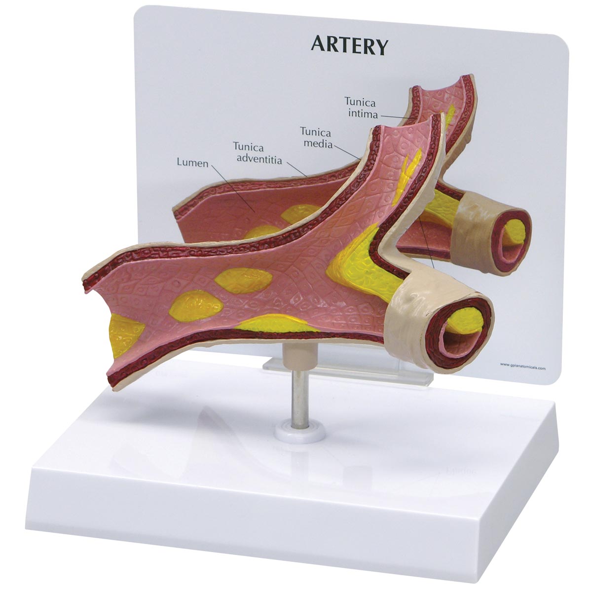 Artery Model - 3B Scientific