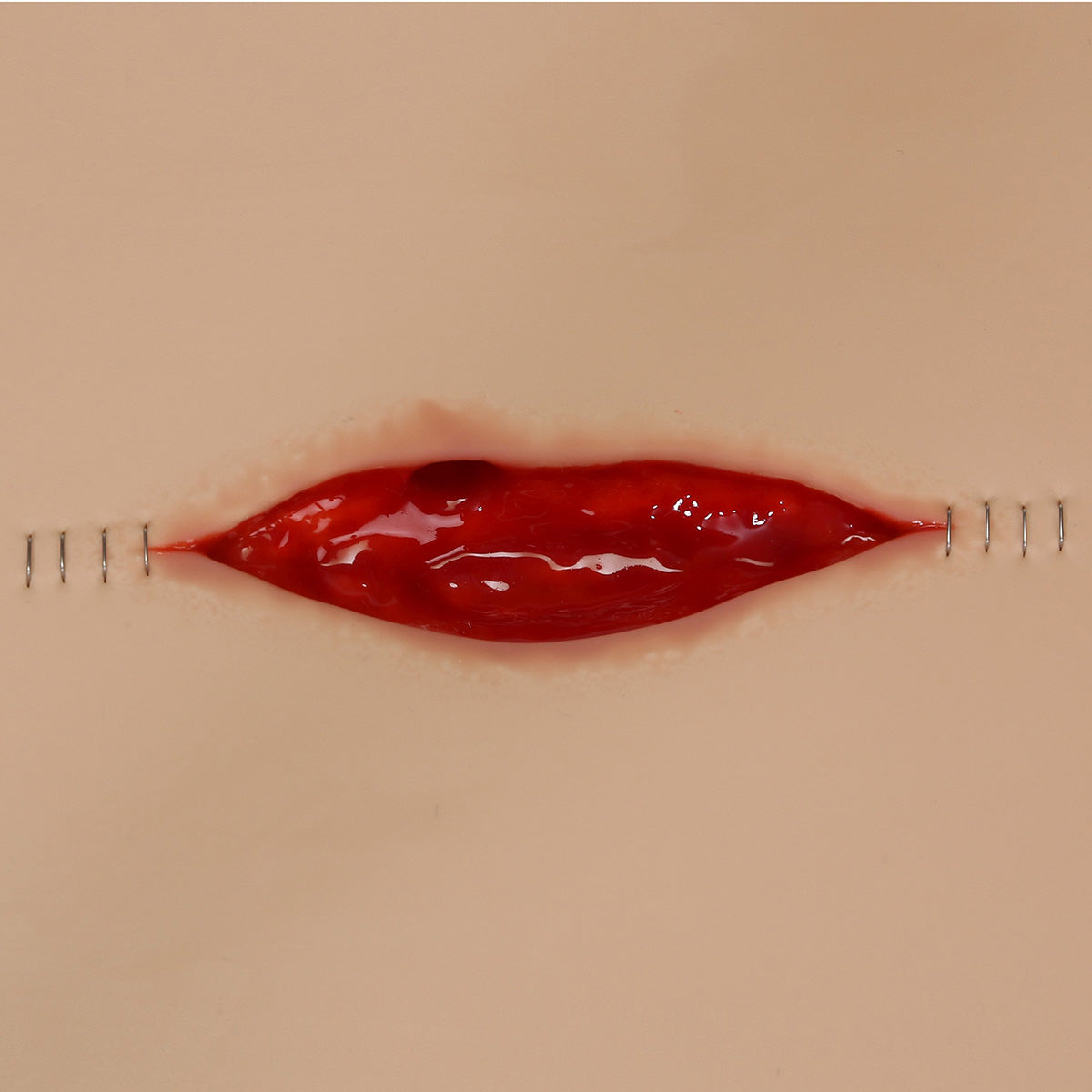 Dehisced Wound Board, light - 3B Scientific