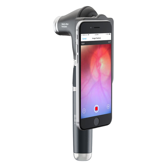 Welch Allyn PanOptic Plus Ophthalmoscope with the iExaminerSmart connectors attached to the back and the image displyed on a phone attached to the iExaminer. The head is attached to a black rechargable handle. Displayed against a white background.