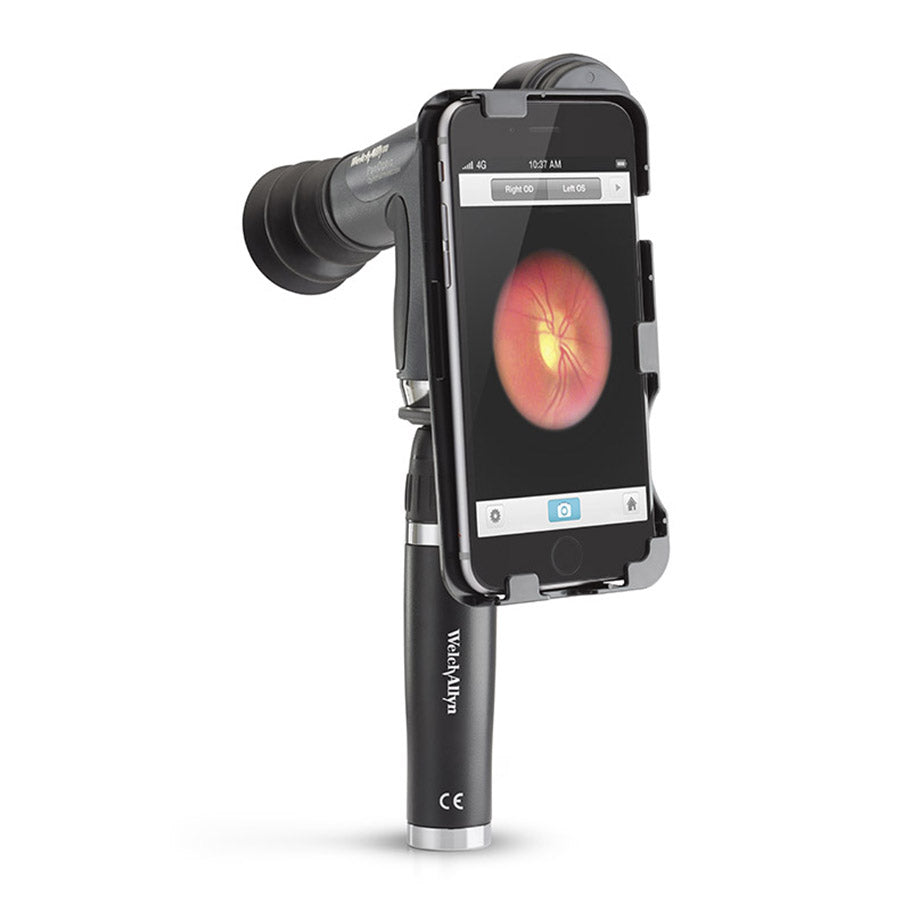 Welch Allyn iExaminer Adaptor for the iPhone 6 and 6S - Welch Allyn