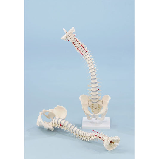 Standard Spine with Prolapse, Pelvis and Stand