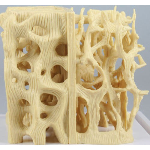 Healthy / Osteoporotic Bone Structure Comparison Model -