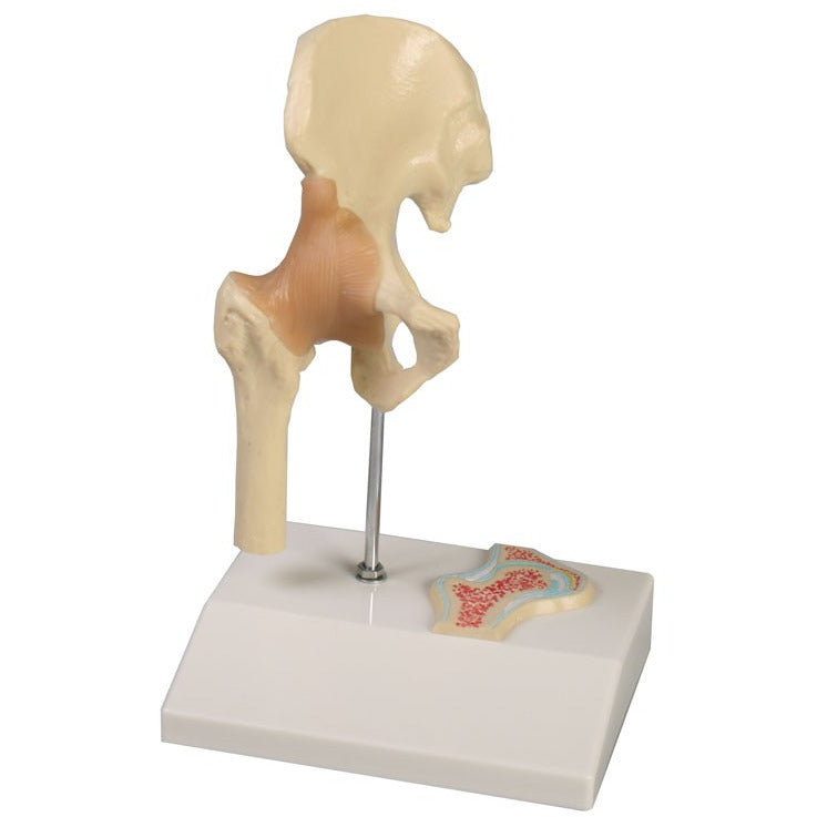 Miniature Hip Joint with Cross Section