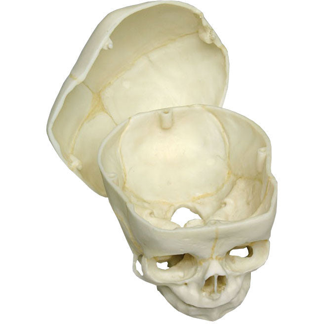 Foetal Skull with Calvarium Cut - 40 Weeks