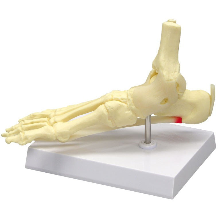 Foot / Ankle with Plantar Fascitis