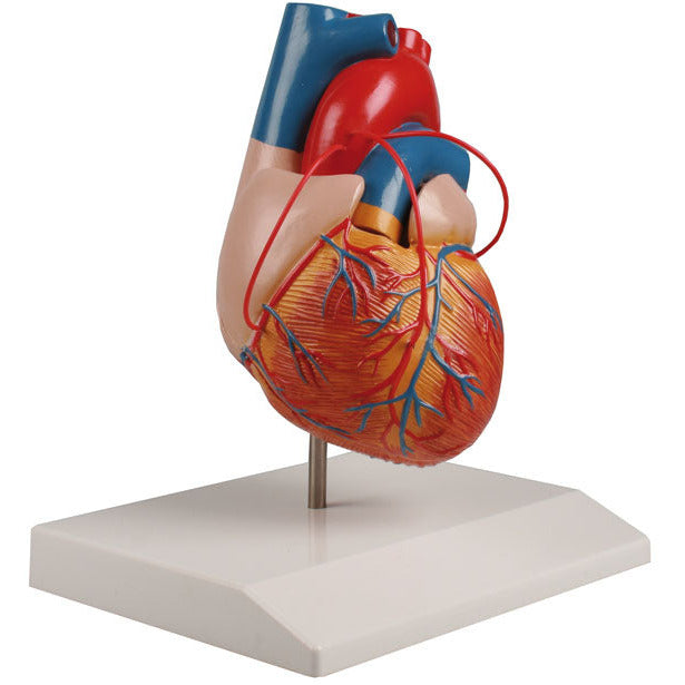 Heart with Bypass - Erler Zimmer