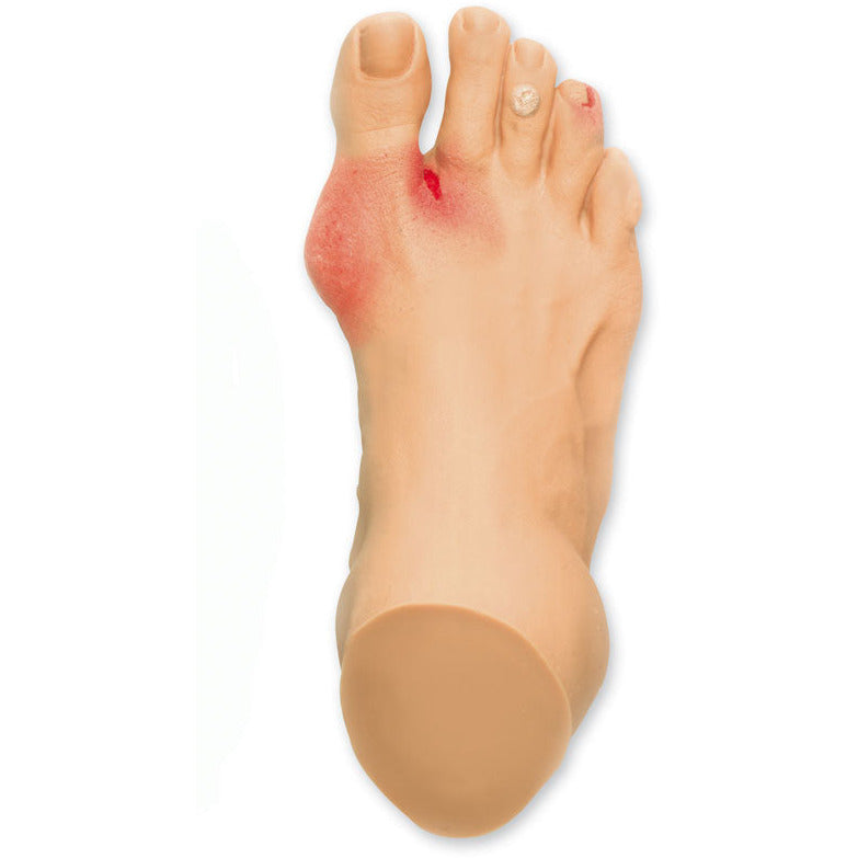 Common Foot Problems - Erler Zimmer