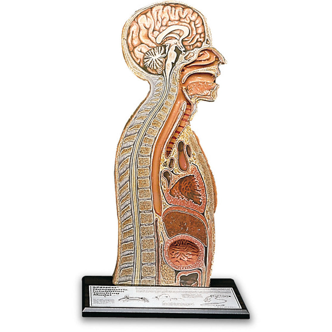 Nasogastric Intubation Model - Health Edco
