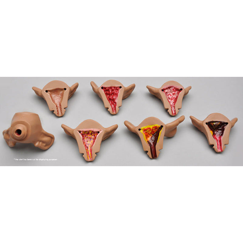 Set of seven uteri for R10183 - Erler Zimmer