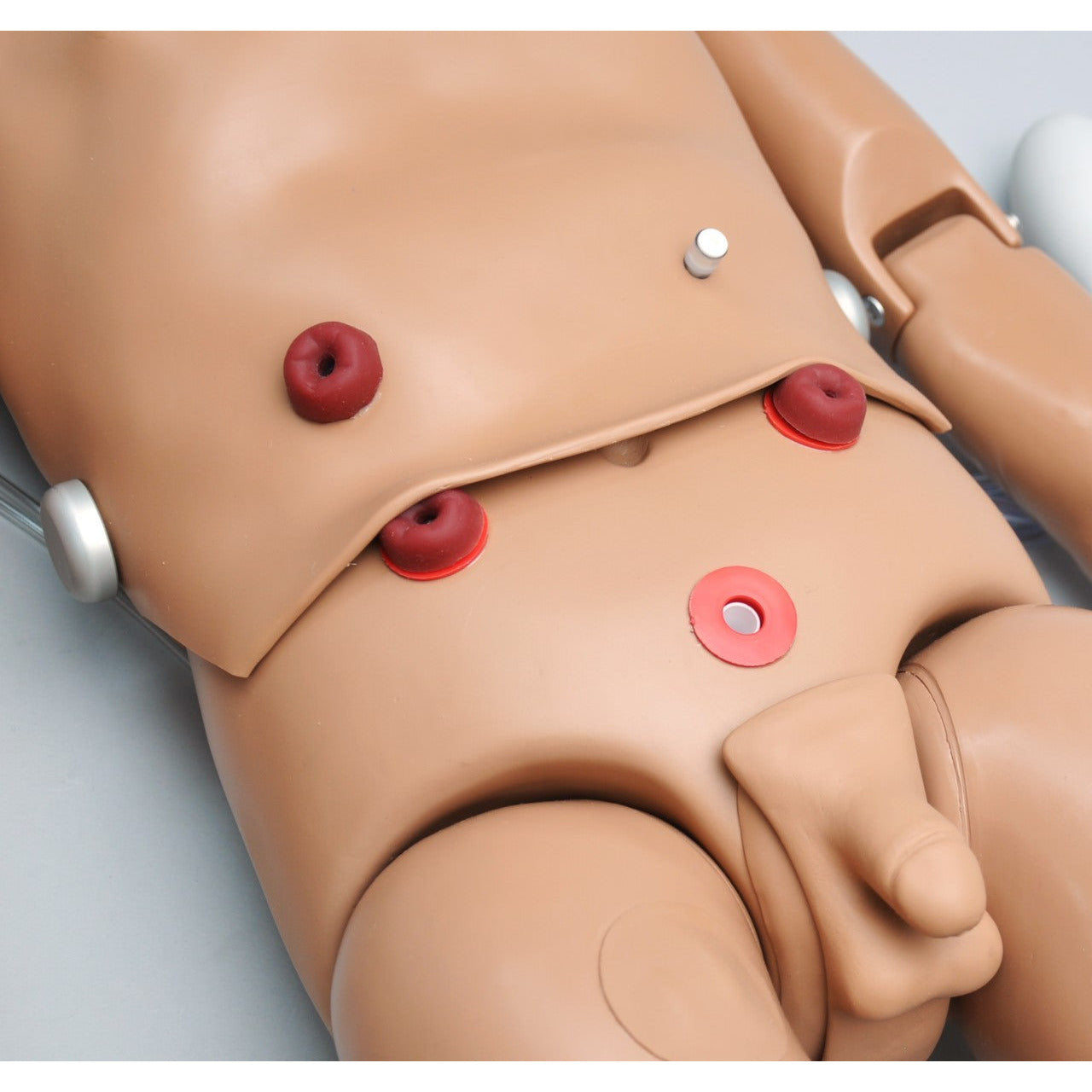 External stoma sites with internal tanks for R17720 - Erler Zimmer