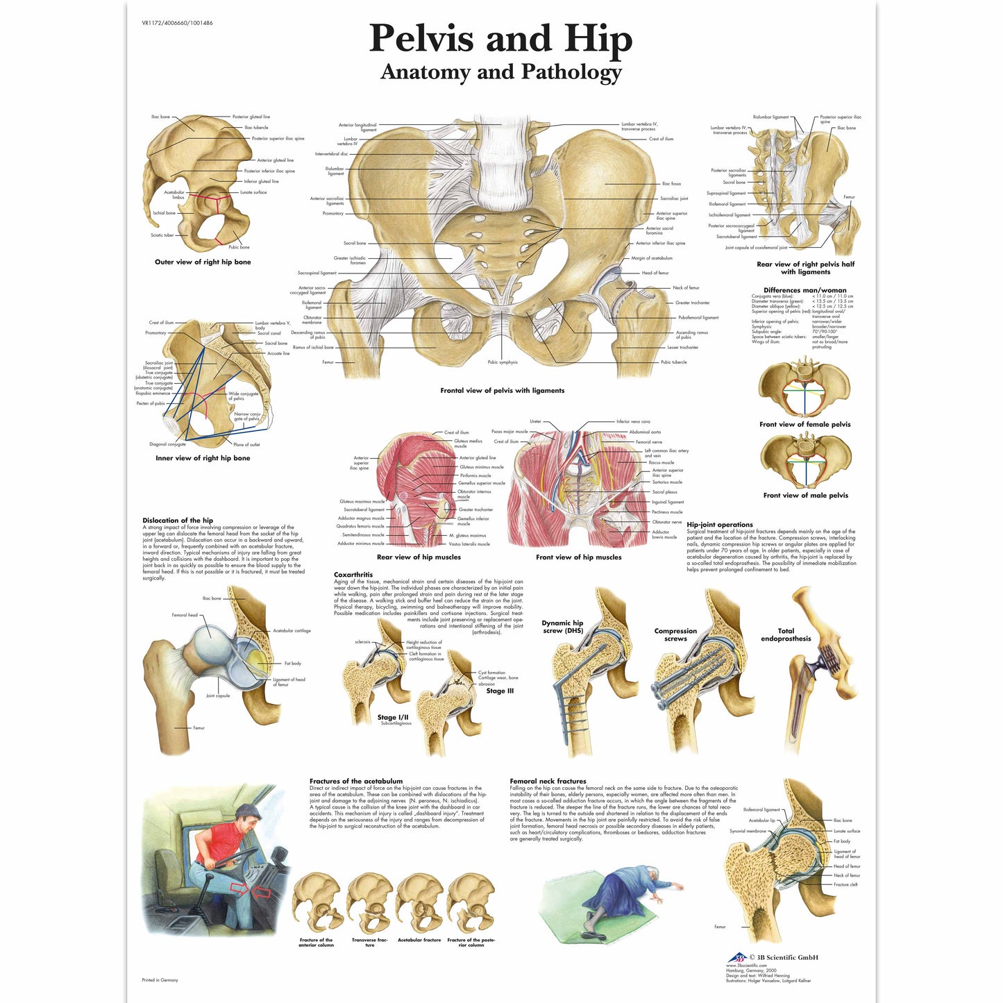 Pelvis and Hip Chart - 3B Scientific