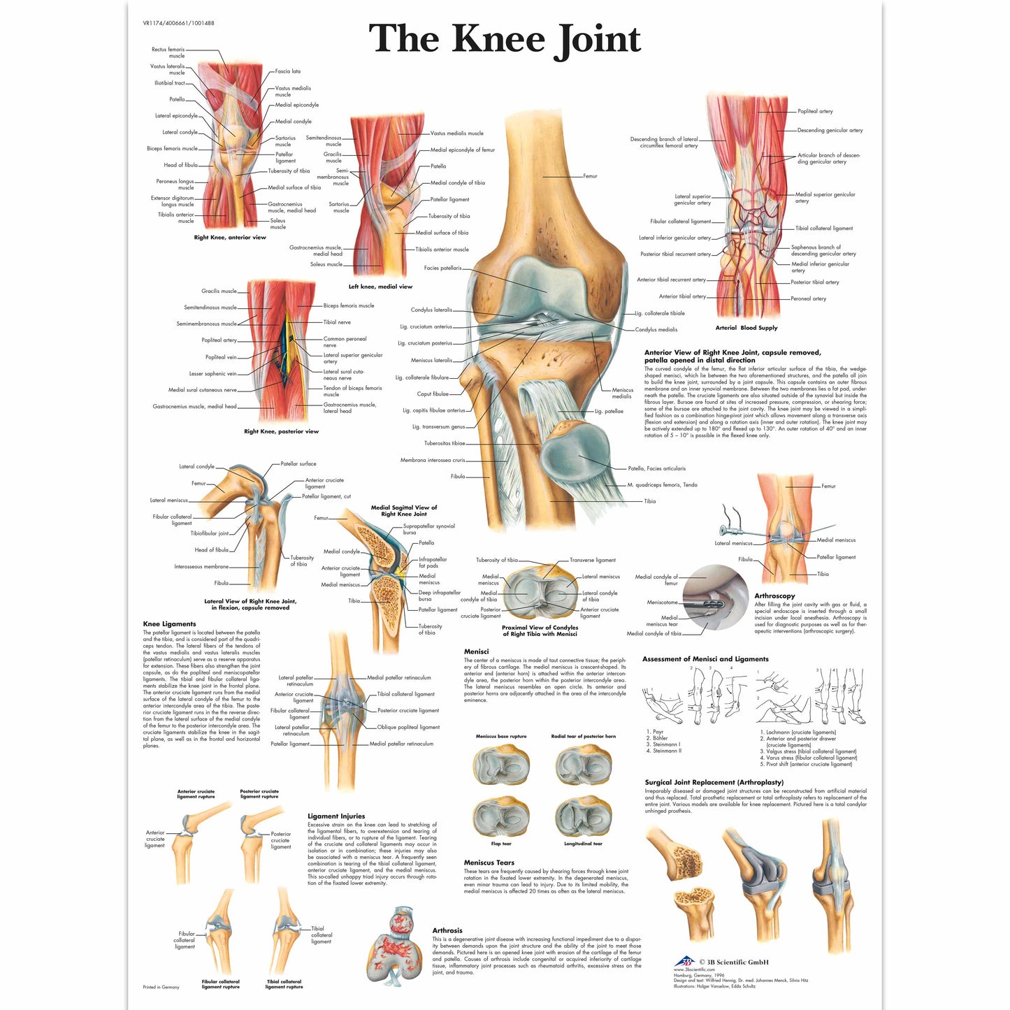Knee Joint Chart - 3B Scientific