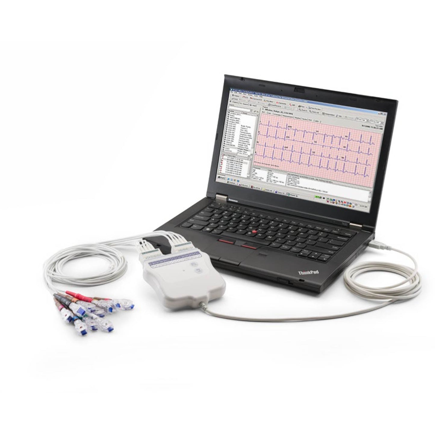 Welch Allyn® Cardioperfect® Workstation PC-Based Resting ECG - Non-Interpretive - Welch Allyn
