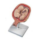 5th Month Twins Model