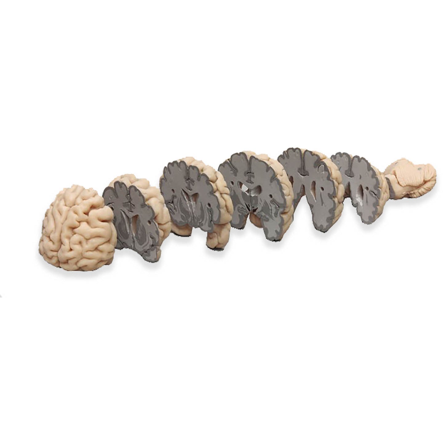Human Brain - Multiple Frontal Sections -