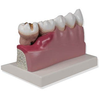 Dental Model - 4 Times Life-Size