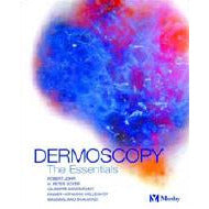 Dermoscopy - the Essentials (Book)
