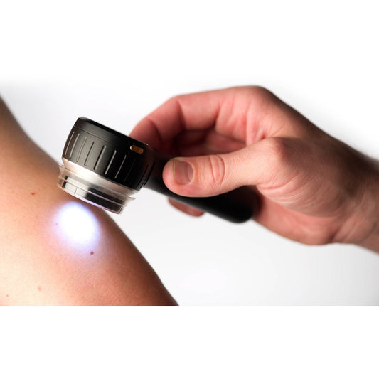 Dermlite DL4 Dermatoscope - Dermlite