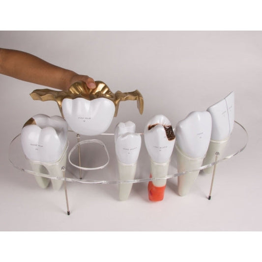 Dental Morphology Series - 7-Part - 10 Times Life-Size - Erler Zimmer