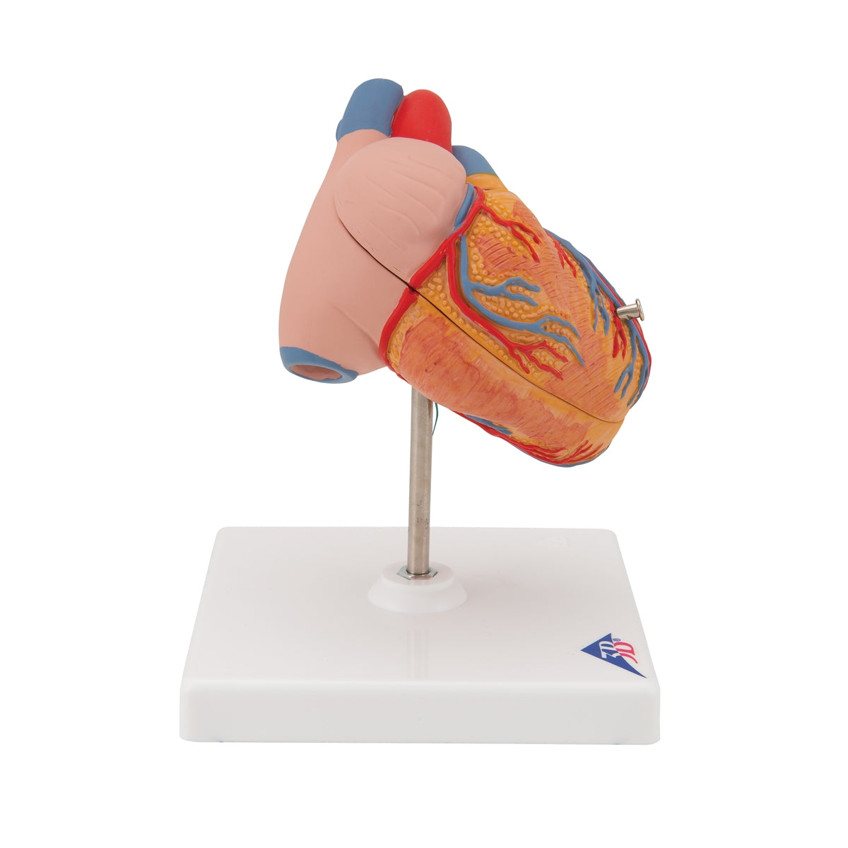 Classic Human Heart Model with Left Ventricular Hypertrophy (LVH), 2 part - 3B Scientific
