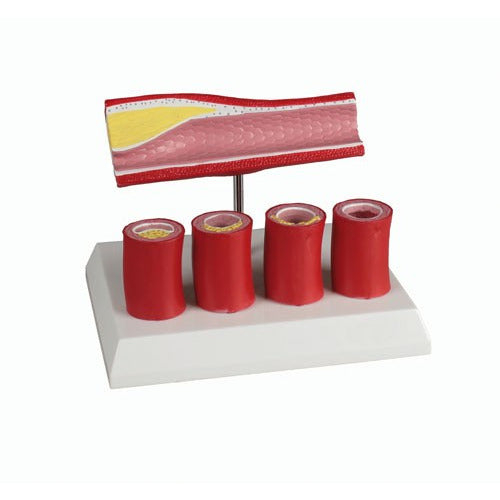 Artery Model with 4 Artery Sections