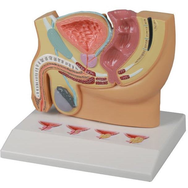 Male Pelvis Section with PBH