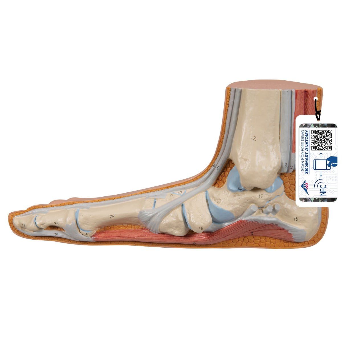 Flat Foot (Pes Planus) Model - 3B Scientific