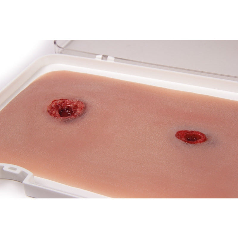 Wound Moulage Bullet Wound, Arm With Bleeding Function - Erler Zimmer