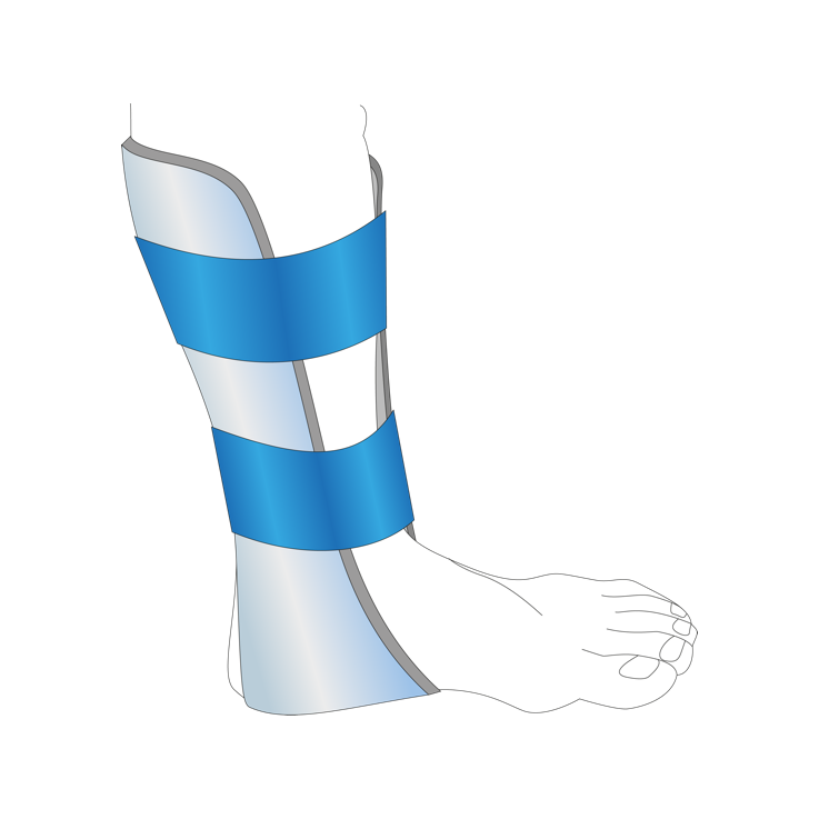 Omni® Splint - Safeguard Medical