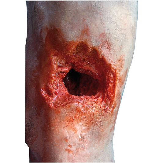 Emergency Leg - Erler Zimmer