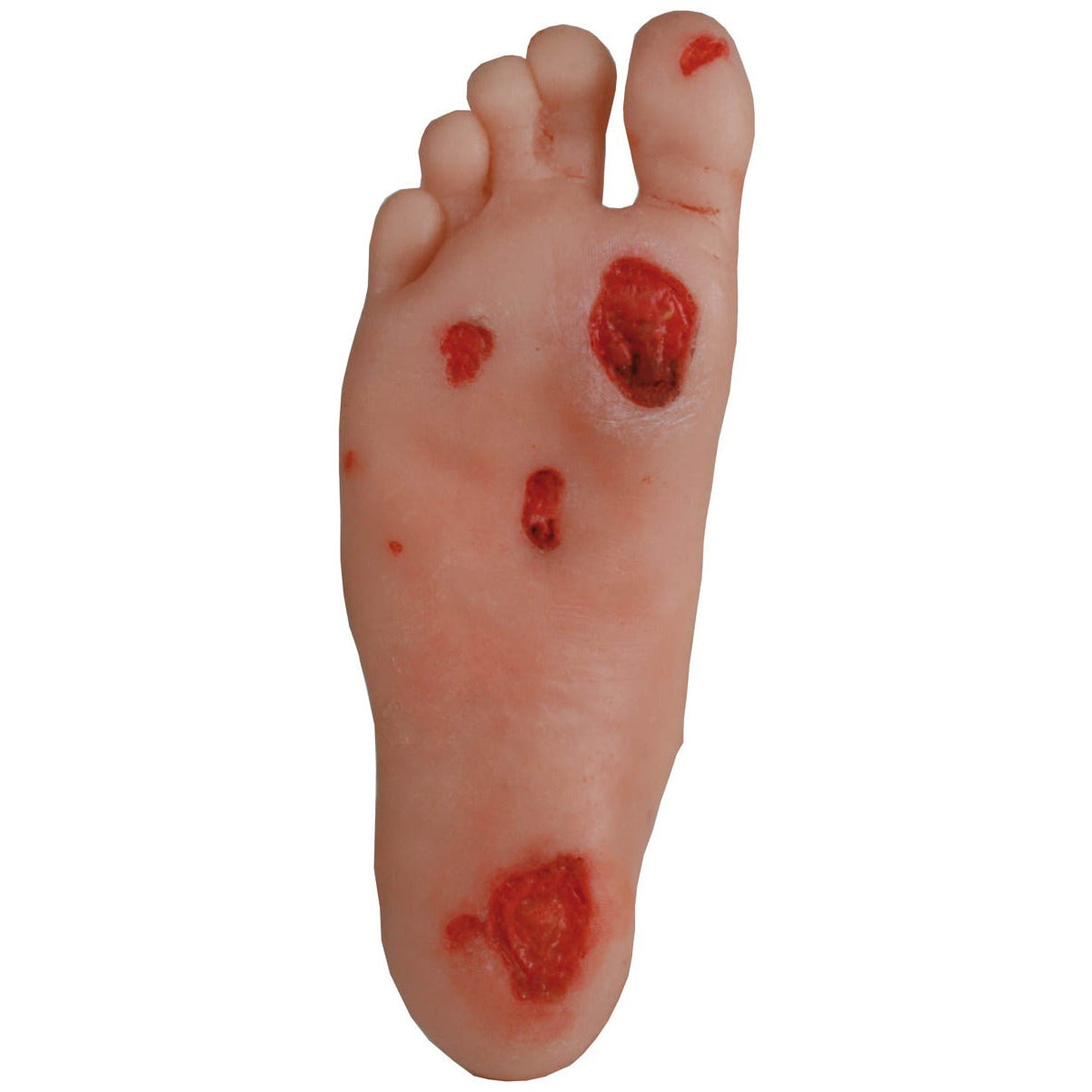 Diabetic Foot Model