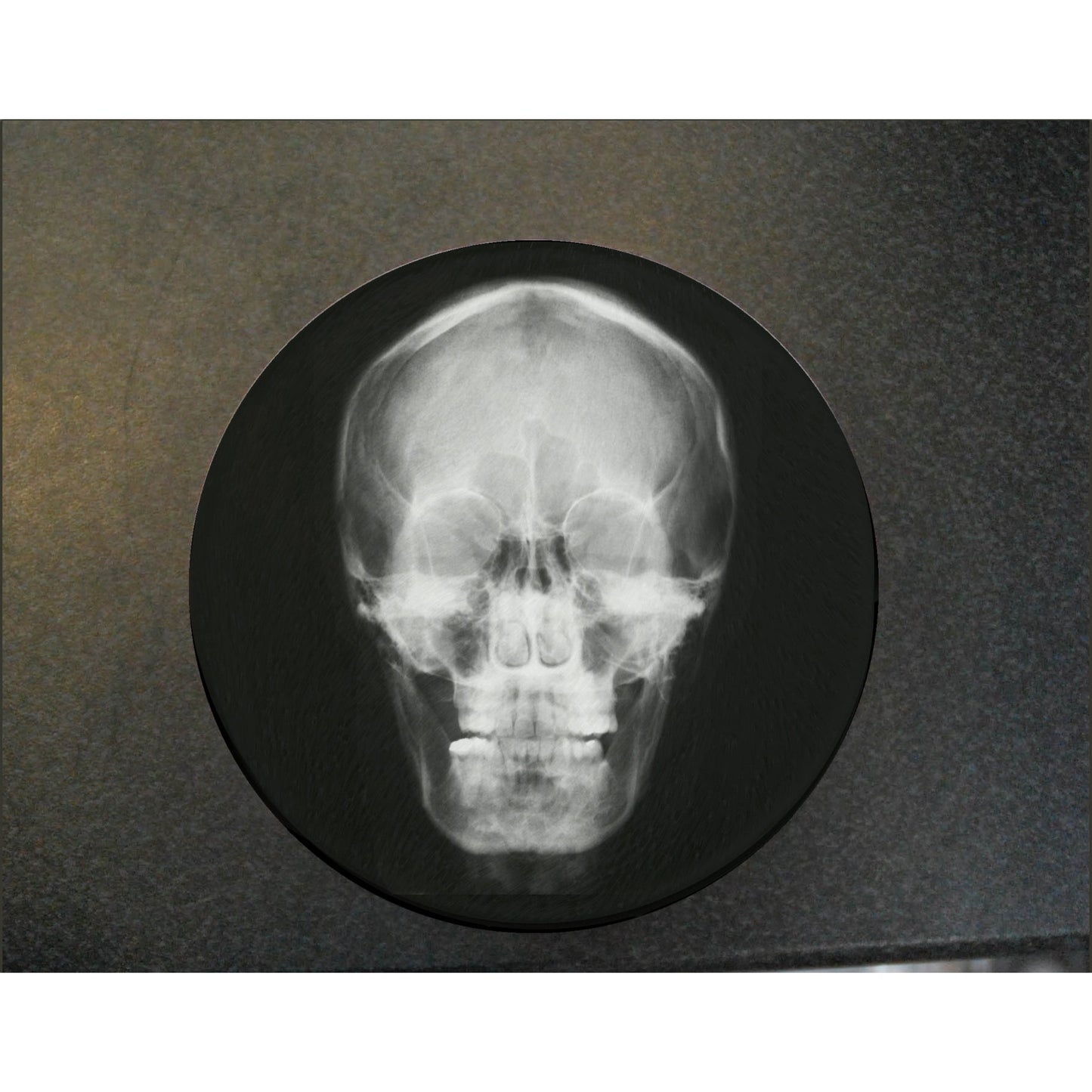 Glass Skull X-Ray Coaster - Medinc