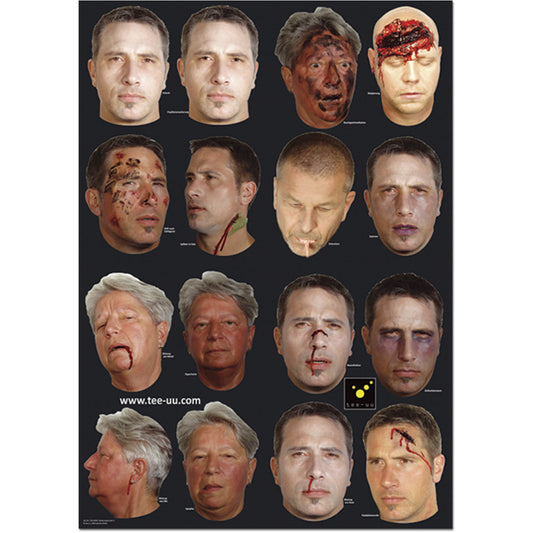 Pattern of Injuries for CRASH & CARRY Mannequin (36 Pieces)