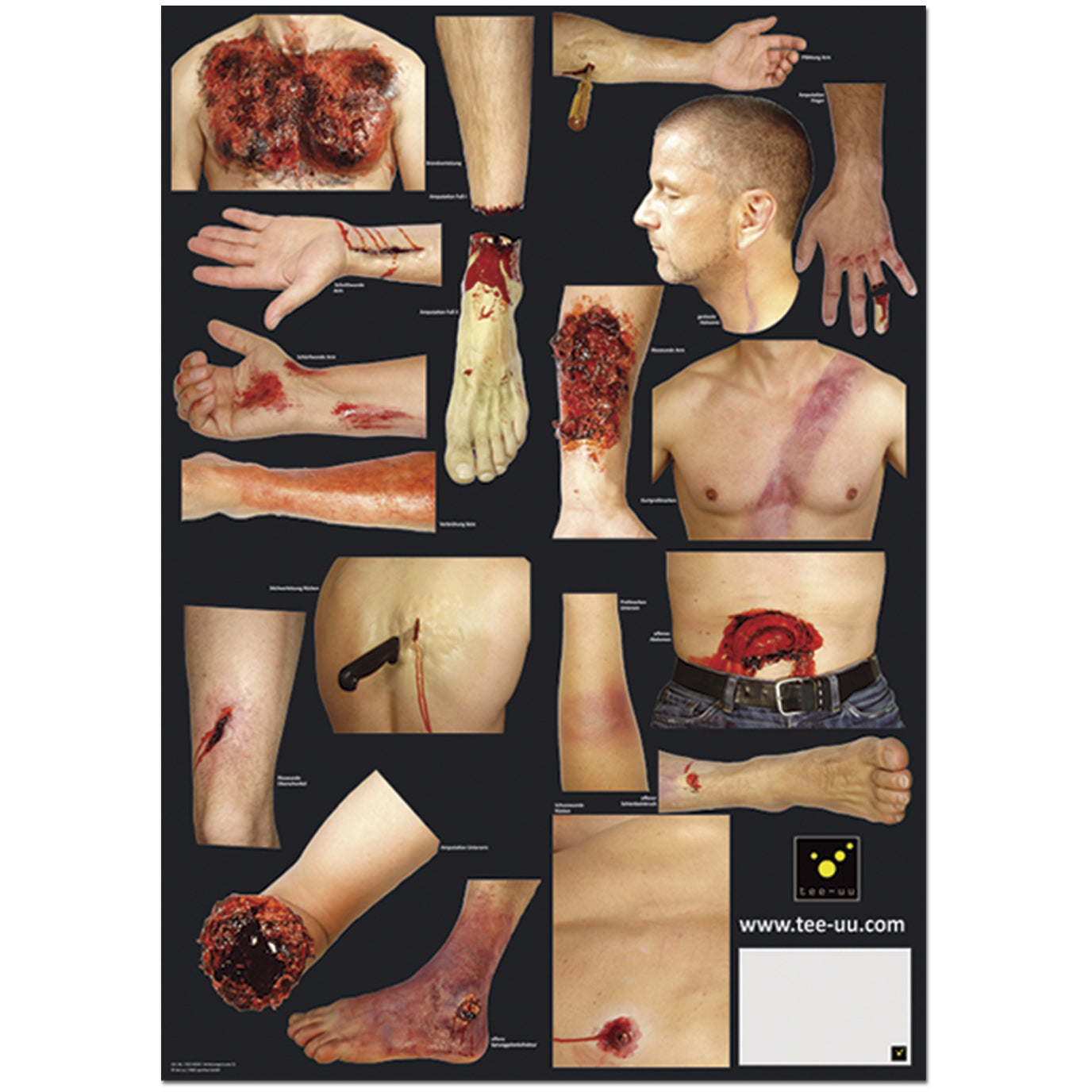 Pattern of Injuries for CRASH & CARRY Mannequin (36 Pieces)