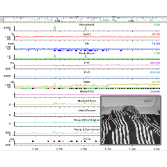 Visi - Download for Pulsox 300i / P300 / UA-300 - Stowood