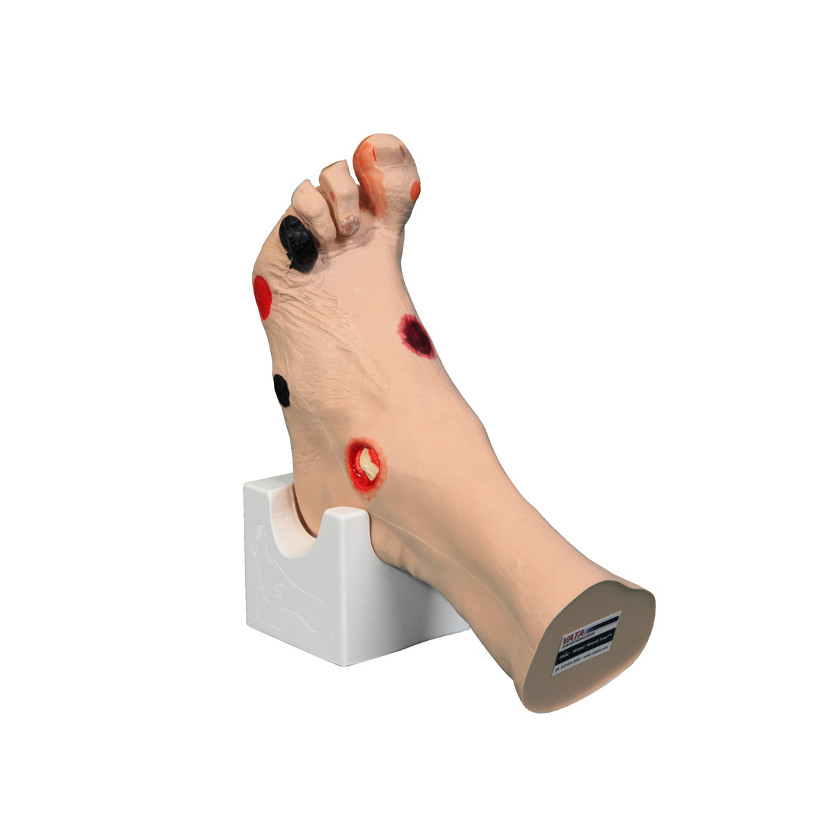 Wilma Wound Foot™ - 3B Scientific