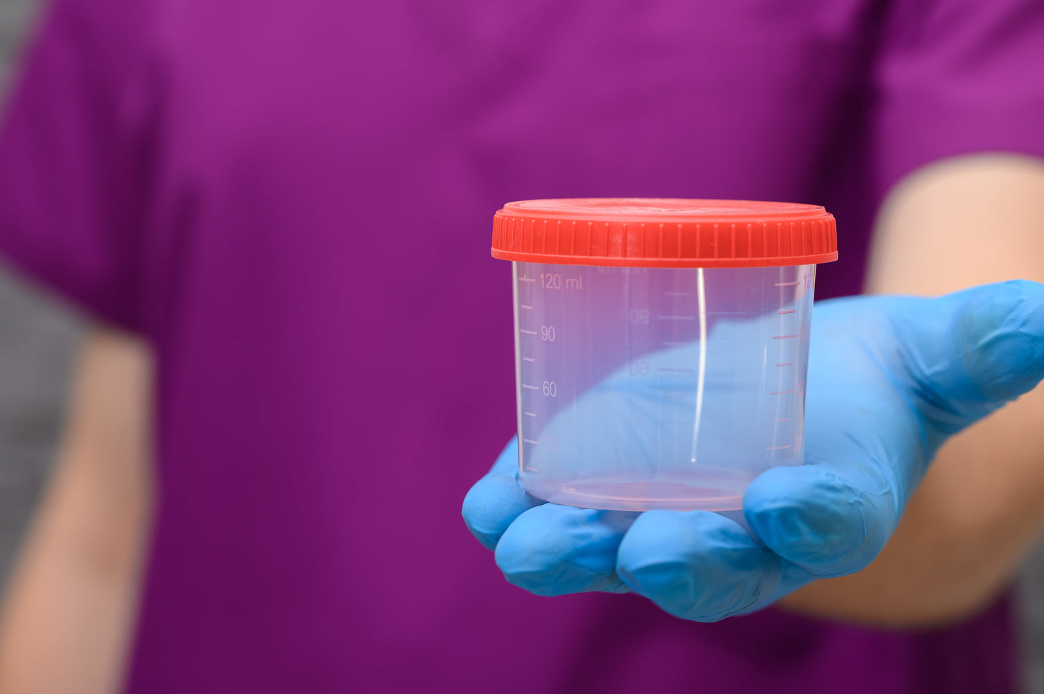 Sample Containers