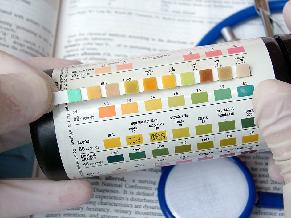 Urinalysis